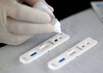 Covid-19: governo confirma meta de testar 46 milhões de brasileiros
