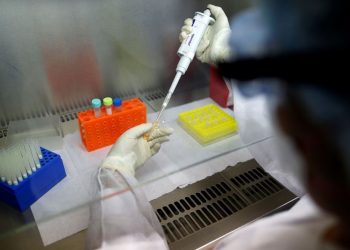 Governo adquire equipamentos que ajudarão testagens da Covid-19