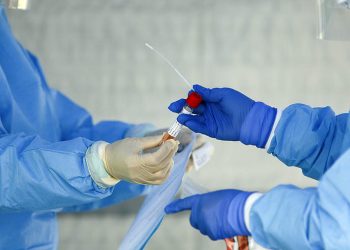 Número de casos do novo coronavírus no Brasil ultrapassa 510 mil