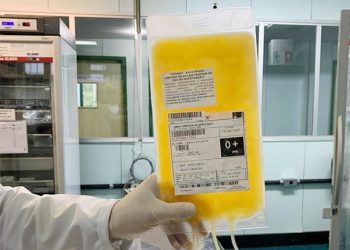 Covid-19: Crise causa impacto na indústria e 69% perdem faturamento