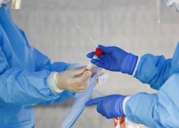 Sesa explica importância de se realizar testes para a comprovação da Covid-19