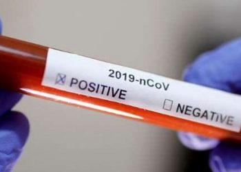 Jaguaré abre semana com 112 Casos Ativos para Covid