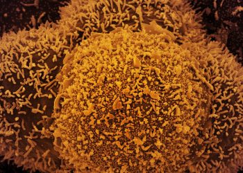 Covid-19 impacta serviços de saúde em 90% dos países, diz OMS