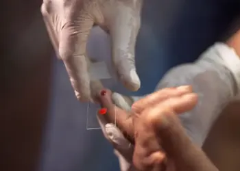 SUS começa a usar novo tratamento contra a malária em crianças